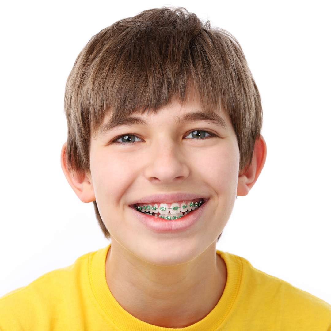 Braces And Aligners