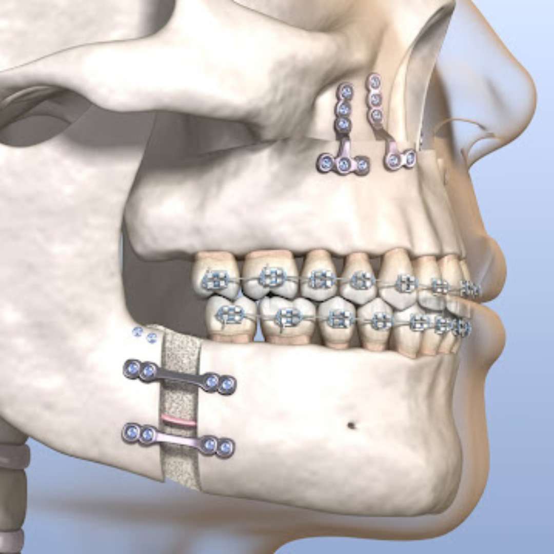 Oral And Maxillofacial Surgery (OMS)